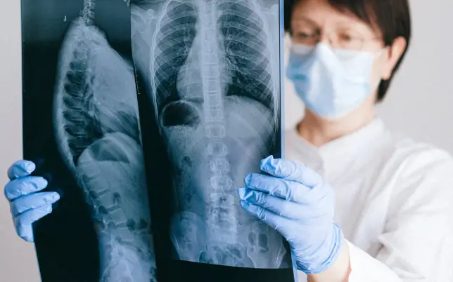 Doctora mirando una radiografía de columna